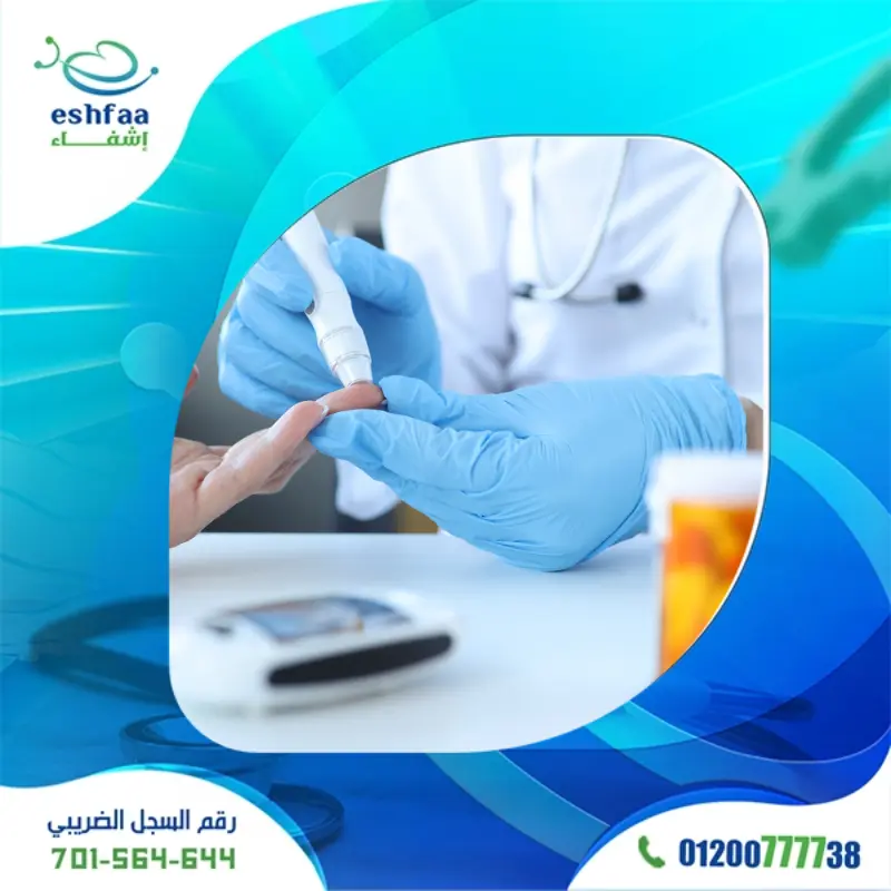 تحليل السكر التراكمي (HbA1c)