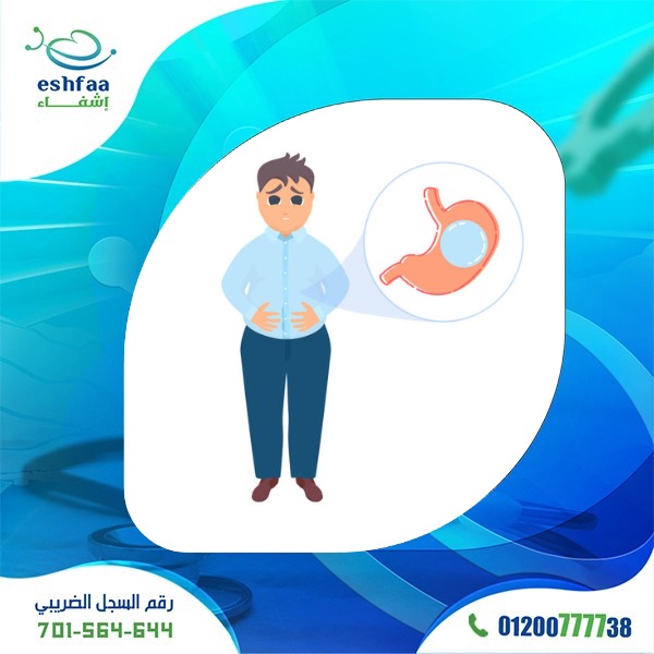 عملية بالون المعدة