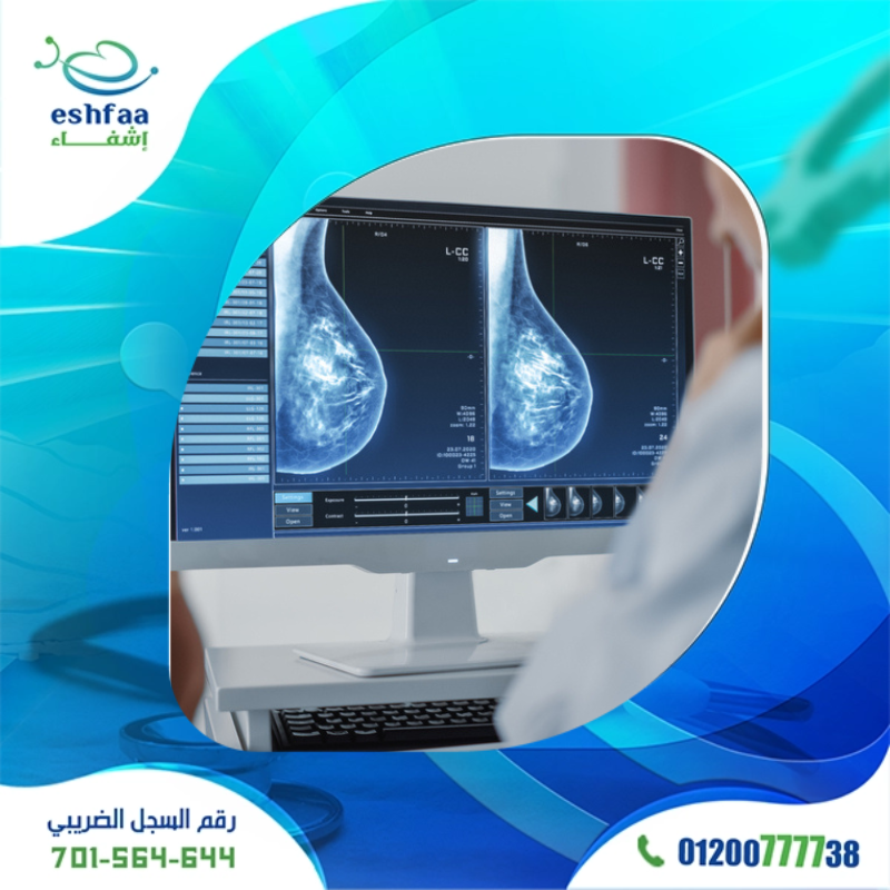  التصوير الشعاعي للثدي