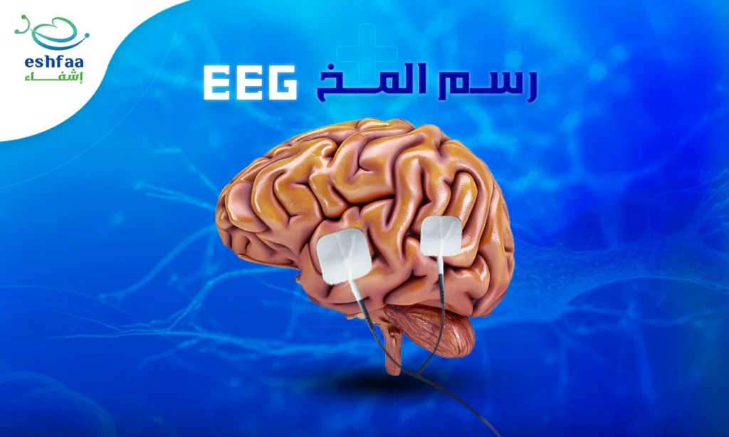 رسم المخ (eeg) ما هو وكيف يجرى وما استخداماته